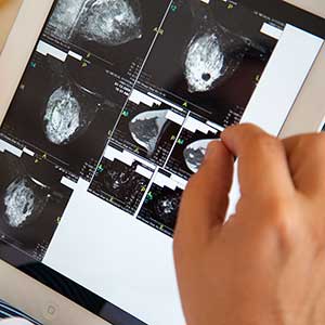 Images from a breast cancer scan are reviewed on a digital tablet held by a health care professional.